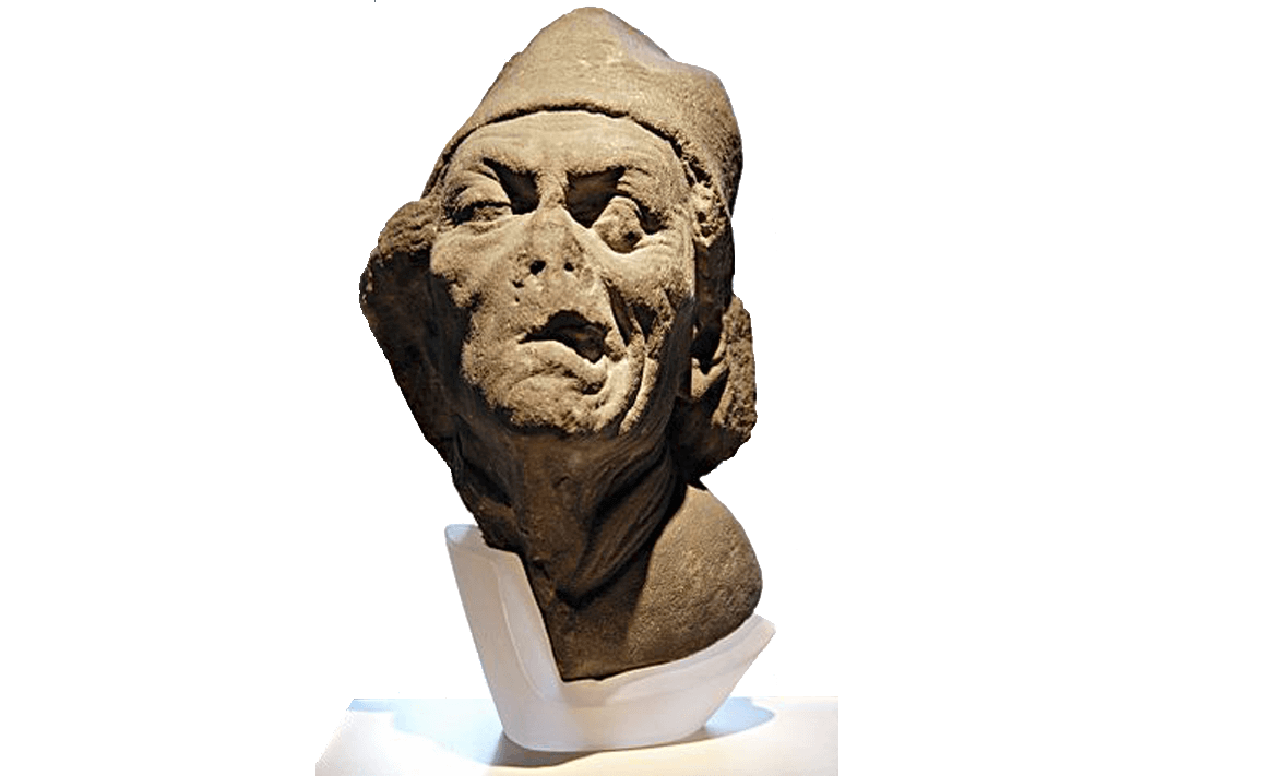 Parálisis Facial